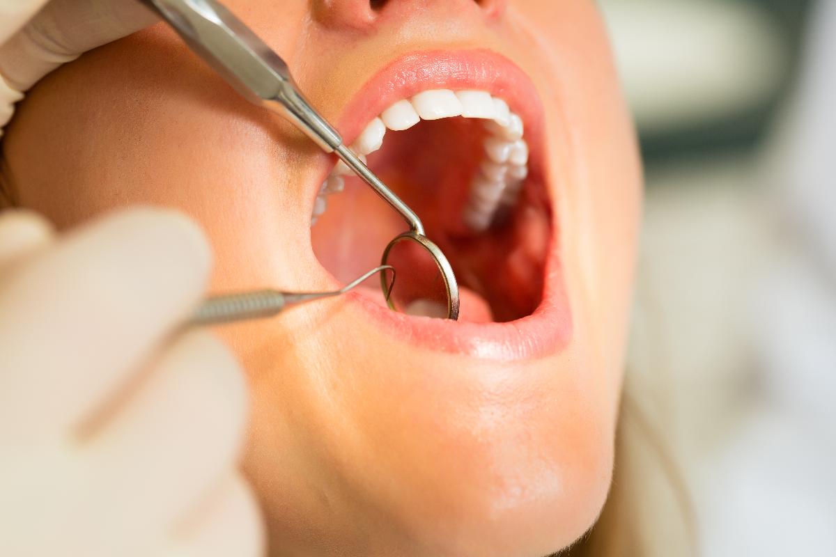 paciente de periodoncia de vitelier clinica dental en coin