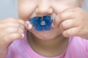 imagen de un niño con un aparato de ortodoncia interceptiva de la clinica dental en coin